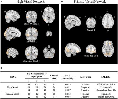 Suicidal Ideation Is Associated With Reduced Functional Connectivity and White Matter Integrity in Drug-Naïve Patients With Major Depression